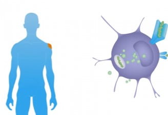 Cancer Vaccine