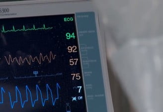 ECMO