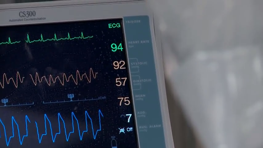 All You Need To Know About Extracorporeal Membrane Oxygenation (Ecmo)