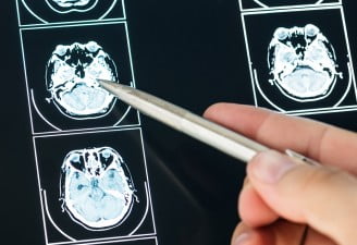 Medical Imaging