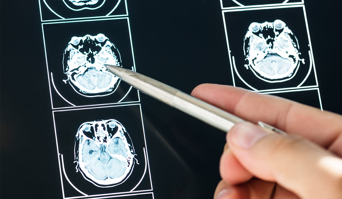Medical Imaging